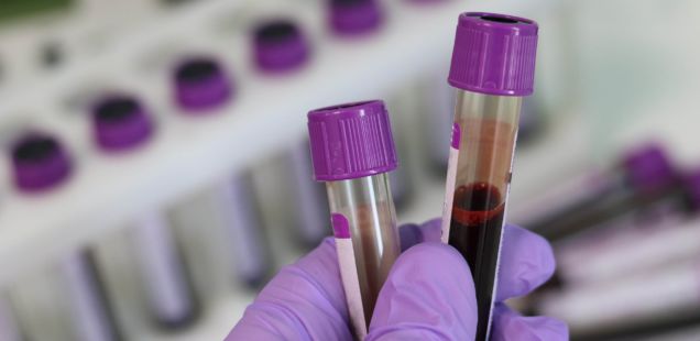 laboratory-3827736_1920-636x310-1